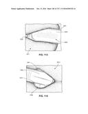 PATIENT INTERFACE AND METHOD FOR MAKING SAME diagram and image