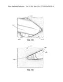 PATIENT INTERFACE AND METHOD FOR MAKING SAME diagram and image