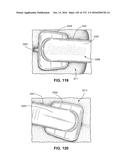 PATIENT INTERFACE AND METHOD FOR MAKING SAME diagram and image