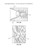 PATIENT INTERFACE AND METHOD FOR MAKING SAME diagram and image