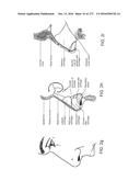 PATIENT INTERFACE AND METHOD FOR MAKING SAME diagram and image