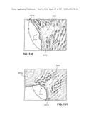 PATIENT INTERFACE AND METHOD FOR MAKING SAME diagram and image