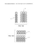 PATIENT INTERFACE AND METHOD FOR MAKING SAME diagram and image