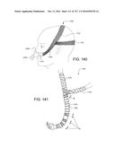 PATIENT INTERFACE AND METHOD FOR MAKING SAME diagram and image