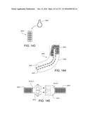 PATIENT INTERFACE AND METHOD FOR MAKING SAME diagram and image