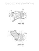 PATIENT INTERFACE AND METHOD FOR MAKING SAME diagram and image