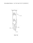 PATIENT INTERFACE AND METHOD FOR MAKING SAME diagram and image