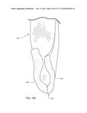 PATIENT INTERFACE AND METHOD FOR MAKING SAME diagram and image