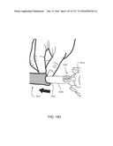 PATIENT INTERFACE AND METHOD FOR MAKING SAME diagram and image