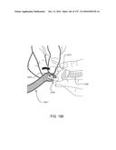 PATIENT INTERFACE AND METHOD FOR MAKING SAME diagram and image