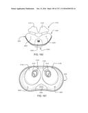 PATIENT INTERFACE AND METHOD FOR MAKING SAME diagram and image