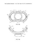 PATIENT INTERFACE AND METHOD FOR MAKING SAME diagram and image