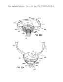 PATIENT INTERFACE AND METHOD FOR MAKING SAME diagram and image