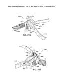 PATIENT INTERFACE AND METHOD FOR MAKING SAME diagram and image