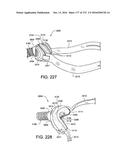 PATIENT INTERFACE AND METHOD FOR MAKING SAME diagram and image