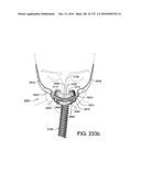 PATIENT INTERFACE AND METHOD FOR MAKING SAME diagram and image