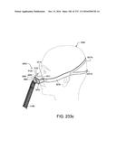 PATIENT INTERFACE AND METHOD FOR MAKING SAME diagram and image