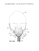 PATIENT INTERFACE AND METHOD FOR MAKING SAME diagram and image