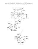 PATIENT INTERFACE AND METHOD FOR MAKING SAME diagram and image