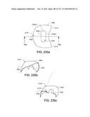 PATIENT INTERFACE AND METHOD FOR MAKING SAME diagram and image