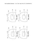 PATIENT INTERFACE AND METHOD FOR MAKING SAME diagram and image