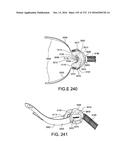 PATIENT INTERFACE AND METHOD FOR MAKING SAME diagram and image