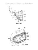 PATIENT INTERFACE AND METHOD FOR MAKING SAME diagram and image