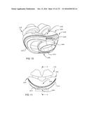 PATIENT INTERFACE AND METHOD FOR MAKING SAME diagram and image