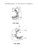 PATIENT INTERFACE AND METHOD FOR MAKING SAME diagram and image