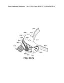 PATIENT INTERFACE AND METHOD FOR MAKING SAME diagram and image