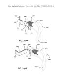 PATIENT INTERFACE AND METHOD FOR MAKING SAME diagram and image