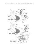 PATIENT INTERFACE AND METHOD FOR MAKING SAME diagram and image