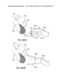 PATIENT INTERFACE AND METHOD FOR MAKING SAME diagram and image