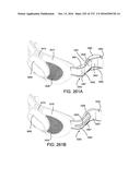 PATIENT INTERFACE AND METHOD FOR MAKING SAME diagram and image