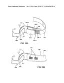 PATIENT INTERFACE AND METHOD FOR MAKING SAME diagram and image