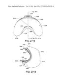 PATIENT INTERFACE AND METHOD FOR MAKING SAME diagram and image