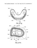 PATIENT INTERFACE AND METHOD FOR MAKING SAME diagram and image