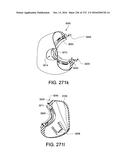 PATIENT INTERFACE AND METHOD FOR MAKING SAME diagram and image