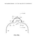 PATIENT INTERFACE AND METHOD FOR MAKING SAME diagram and image