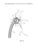 PATIENT INTERFACE AND METHOD FOR MAKING SAME diagram and image