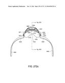 PATIENT INTERFACE AND METHOD FOR MAKING SAME diagram and image