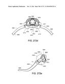 PATIENT INTERFACE AND METHOD FOR MAKING SAME diagram and image