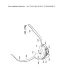 PATIENT INTERFACE AND METHOD FOR MAKING SAME diagram and image