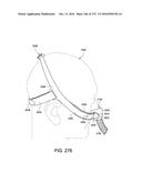 PATIENT INTERFACE AND METHOD FOR MAKING SAME diagram and image