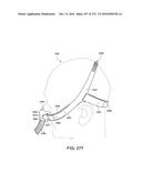 PATIENT INTERFACE AND METHOD FOR MAKING SAME diagram and image