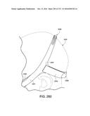 PATIENT INTERFACE AND METHOD FOR MAKING SAME diagram and image