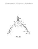 PATIENT INTERFACE AND METHOD FOR MAKING SAME diagram and image