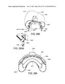 PATIENT INTERFACE AND METHOD FOR MAKING SAME diagram and image