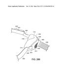 PATIENT INTERFACE AND METHOD FOR MAKING SAME diagram and image