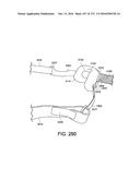 PATIENT INTERFACE AND METHOD FOR MAKING SAME diagram and image